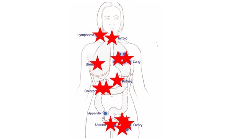 first-study-of-multicancer-blood-test-to-screen-for-cancer-guide